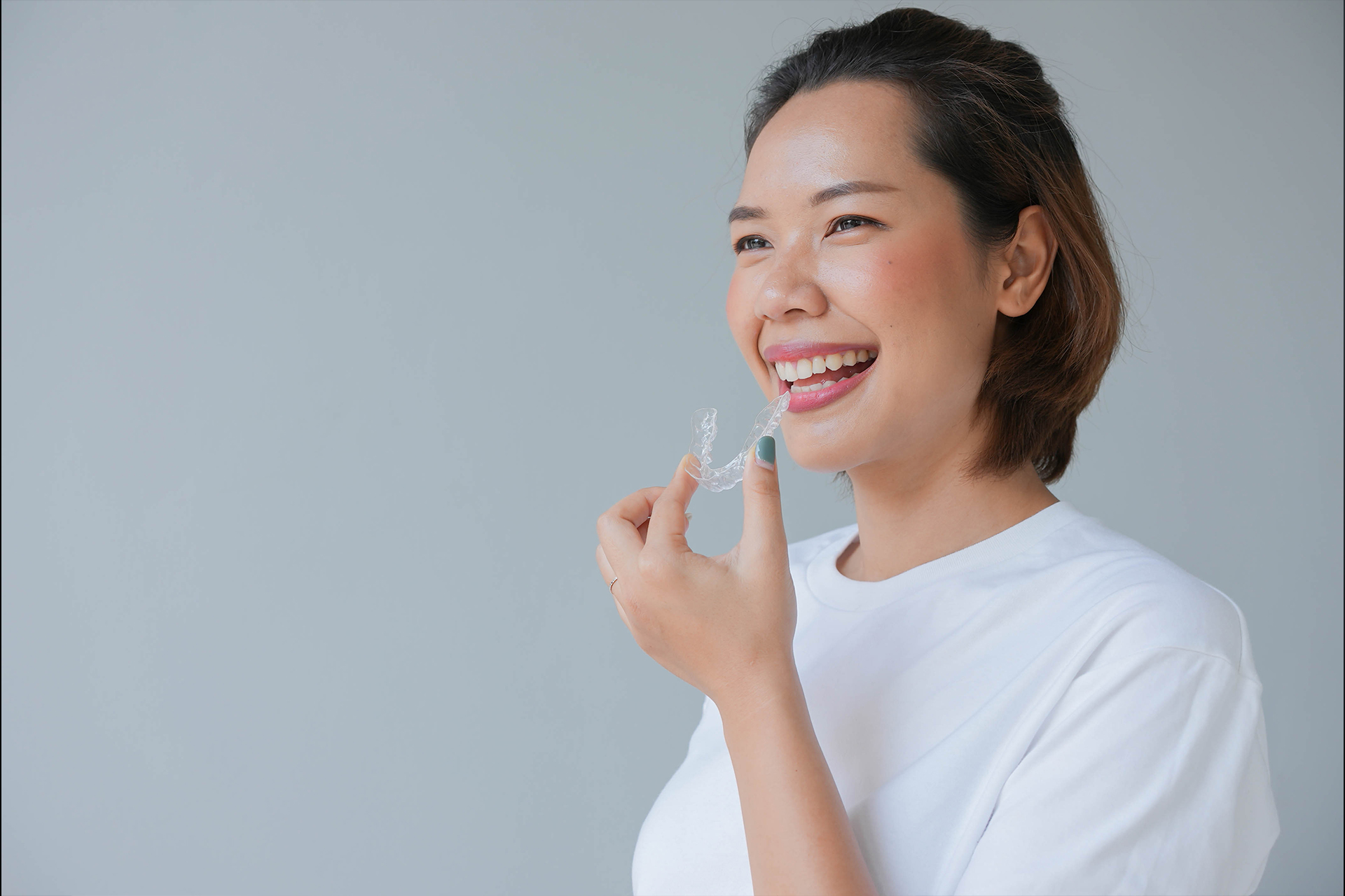 Invisalign Routine Clear Aligners in Karama - Invisible Aligner in Karama