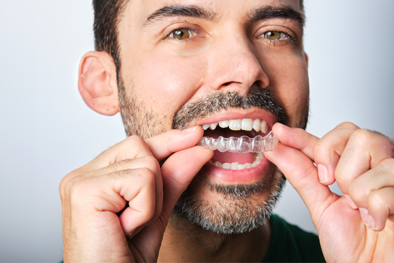 man using the retainers